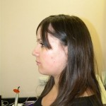 profile lips closed dental tourism