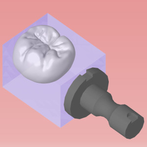 CEREC blockcomputerized dentistry