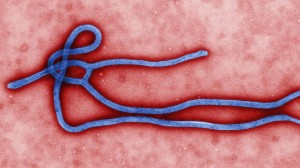Ebola and Dentistry