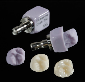 Emax cad porcelain