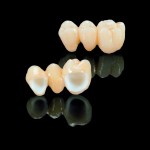 zirconia Porcelain Crowns