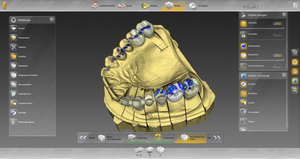 Cerec Inlab in Israel