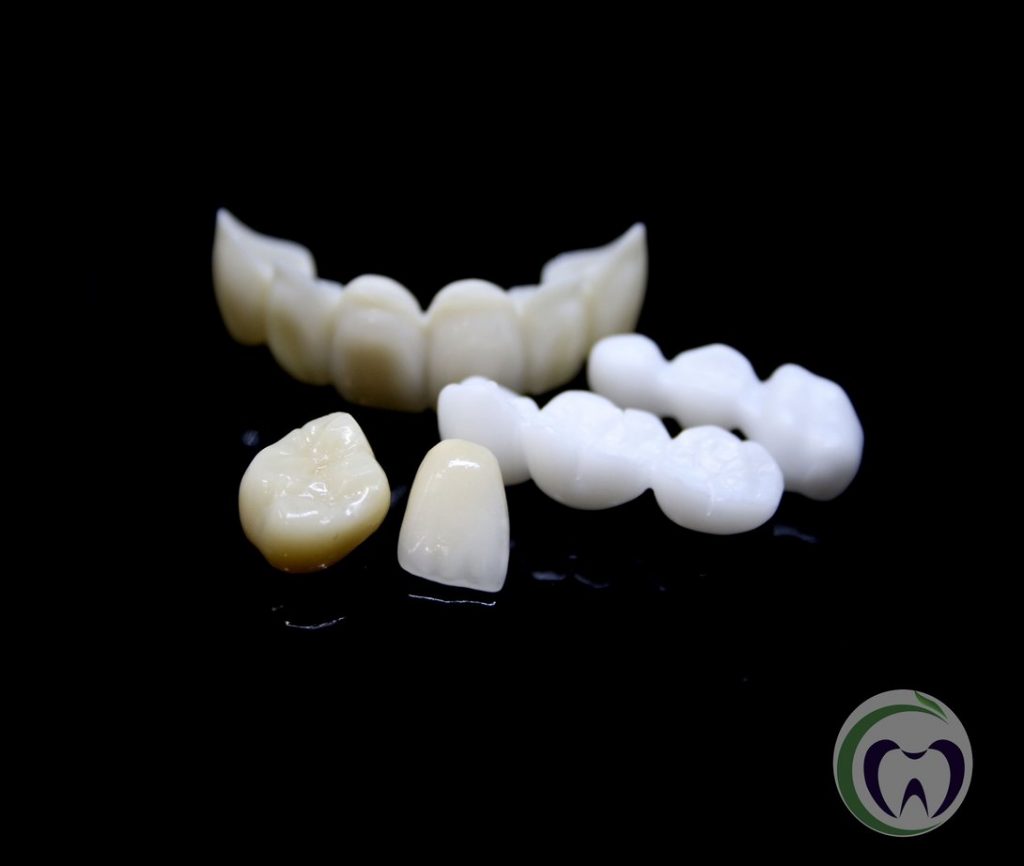 zirconia crowns