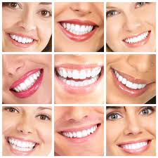 סקר דייטים 2013 מציג שיניים כהכי חשובות